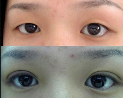 唐山哪家鼻子整形醫(yī)院好？權(quán)威專家為您解答