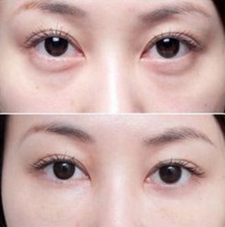 杭州厚唇變薄醫(yī)院哪家好？