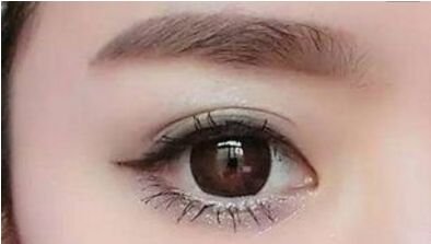 沈正洲如何進行雙眼皮手術(shù)？醫(yī)生介紹、手術(shù)費用、成功案例、患者口碑分享