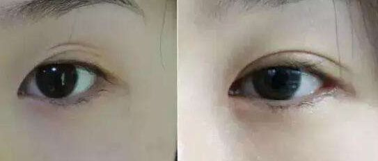 南京哪家假體豐胸醫(yī)院好？醫(yī)術精湛、效果明顯的南京豐胸專科醫(yī)院推薦