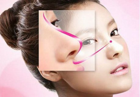 深圳駝峰鼻矯正哪家好？專業(yè)醫(yī)生推薦與真實案例分享！