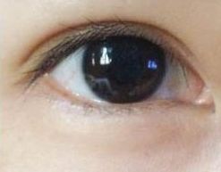 蘇州哪家祛痘醫(yī)院好？專家推薦的治療痘痘效果好的醫(yī)院