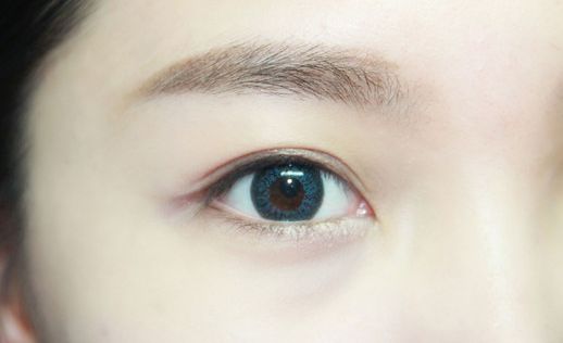無錫頸脖紋線雕整形醫(yī)院推薦指南：提升魅力，告別頸紋困擾