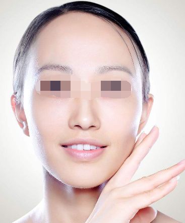 開(kāi)眼角能讓眼睛看起來(lái)更大？現(xiàn)實(shí)經(jīng)驗(yàn)告訴你答案！