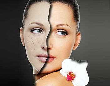 北京雙眼皮修復(fù)的效果如何？什么狀況需要做雙眼皮修復(fù)？