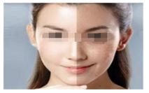 吃海鮮對于使用瘦腿針的人來說是否適合？