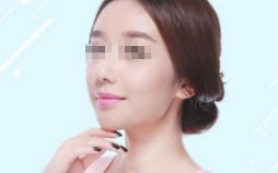 雙眼皮修復(fù)，選對(duì)時(shí)機(jī)，展現(xiàn)美麗眼眸