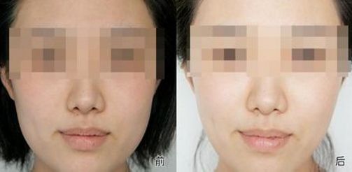 有效改善黑眼圈的飲食和作息調(diào)整方法！