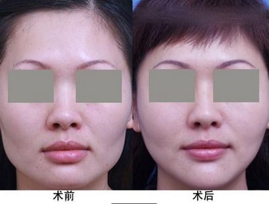 生姜洗發(fā)水哪個牌子好用，一線大品牌值得推薦