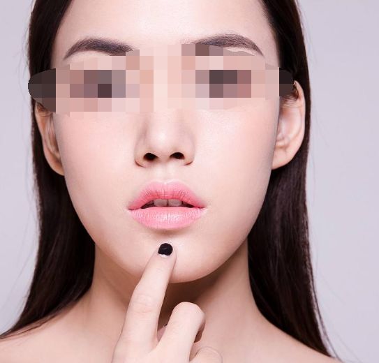 透明質酸隆鼻注射后：如何避免過敏癥狀的突發(fā)