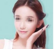 孫儷的容顏變化引發(fā)熱議，她真的進行了整容嗎？