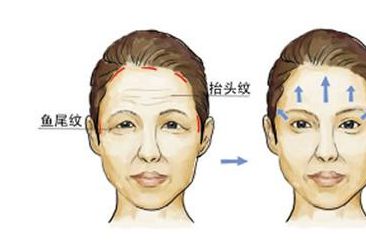 胸部整形費用不同？這些因素竟會影響價格