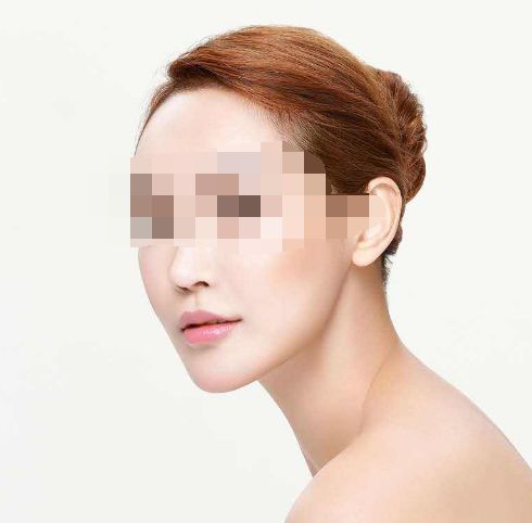 處女膜修復(fù)手術(shù)成功率及手術(shù)過程詳解