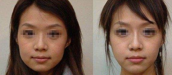長(zhǎng)期外眼角傷害視力？這樣保護(hù)眼睛更有效！