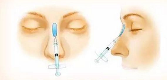 美白祛斑的方法有哪些？4種醫(yī)美美肌方案推薦