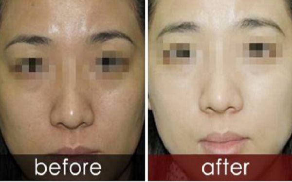 曬黑后如何迅速變白？曬黑美白需要持續(xù)護(hù)理多久結(jié)果可見(jiàn)？了解曬后護(hù)膚科普！