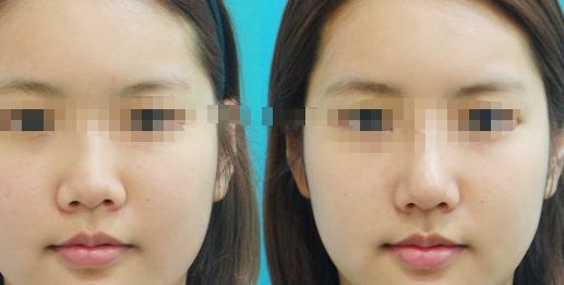 紀(jì)輝私人制造設(shè)備，安全可靠嗎？