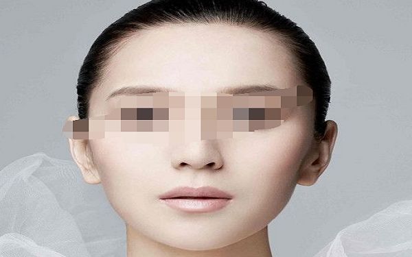 雙眼皮修復(fù)技術(shù) 解決割雙眼皮不完美的問(wèn)題