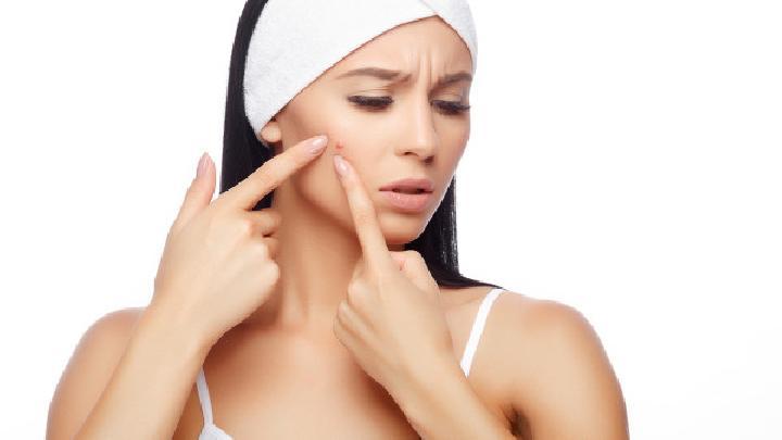 女生如何快速消除痘痘？祛痘的有效方法有哪些？