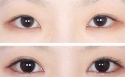 南京中醫(yī)院優(yōu)秀雙眼皮專家推薦，值得信賴！完善的醫(yī)生介紹、項目介紹及價格表供參考
