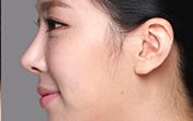 東莞第五人民醫(yī)院美容科綜合評價及專家推薦！