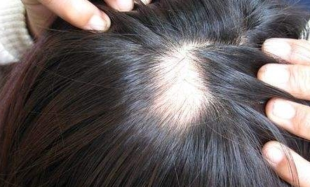 南京新生醫(yī)院植發(fā)效果如何？坐診專家簡介、詳細(xì)地址一覽