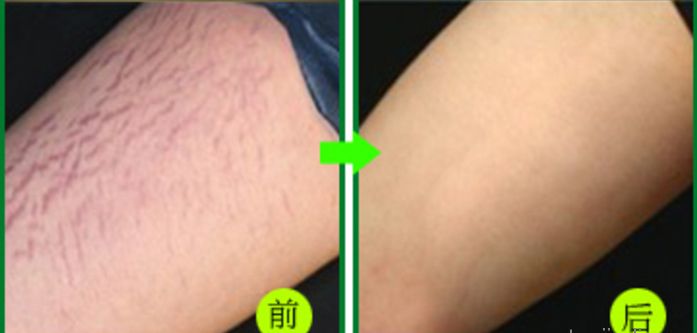 杭州整容醫(yī)院推薦，這幾家非常值得選擇