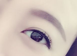 劉春軍豐胸手術(shù)后效果如何？費(fèi)用怎么樣？醫(yī)生概況+隆胸真實(shí)案例圖為參考