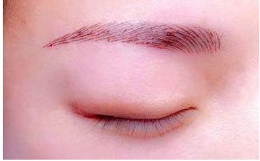 深圳醫(yī)生劉冰的鼻子整形效果如何？專業(yè)實力及成功案例發(fā)布