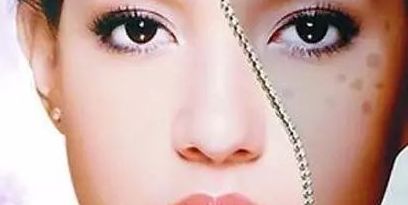 上海眼部修復(fù)專家推薦，治療眼部問(wèn)題可信賴！