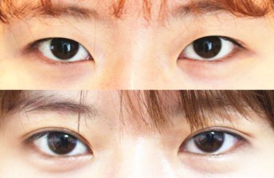 蚌埠醫(yī)學(xué)院第一附屬醫(yī)院眼科權(quán)威專家推薦！
