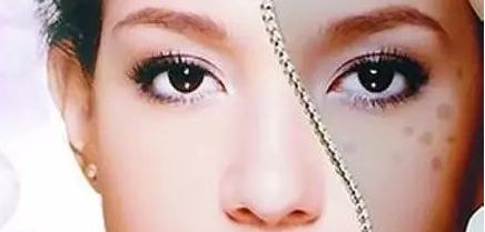 周一雄如何預(yù)約雙眼皮手術(shù)？案例分享與價(jià)格真實(shí)評(píng)估