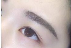 重慶銅雀臺地區(qū)雙眼皮手術頂級醫(yī)生推薦！詳細收費一覽表