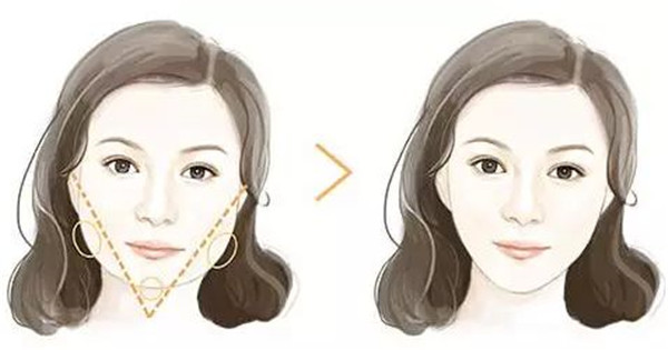 深圳吸脂修復(fù)醫(yī)院哪家專業(yè)？這八強(qiáng)機(jī)構(gòu)到底有何絕技？