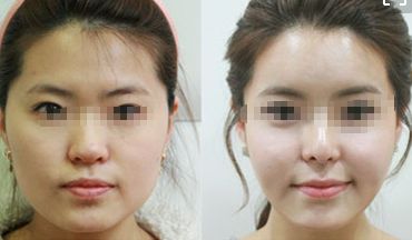 重慶頂級整形美容醫(yī)院排行榜 重慶頂級整形美容醫(yī)院排行榜