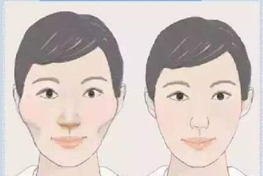 曼托與傲諾拉豐胸材料對(duì)比：功能與差異解析