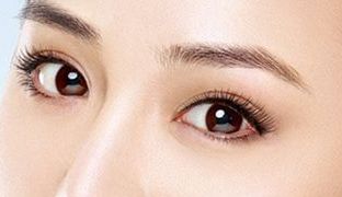 成都米蘭柏羽雙眼皮曝光！醫(yī)生做雙眼皮風(fēng)格如何？對(duì)比照片供參考