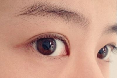 如何選擇適合自己的祛斑醫(yī)院？哪些醫(yī)院是值得嘗試的？