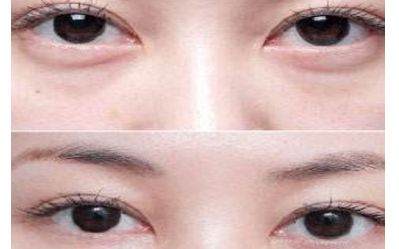 云南雙眼皮醫(yī)生排行榜2023：揭秘5位頂尖專家，讓您輕松煥發(fā)雙目魅力！