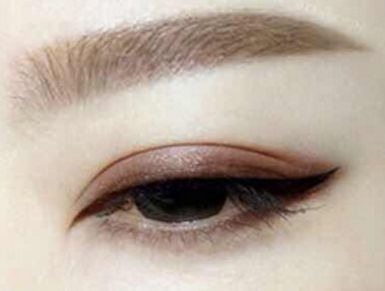 成都美萊雷狀醫(yī)生2023年隆鼻案例揭示:美貌與自然魅力統(tǒng)一修復 成都美萊雷狀醫(yī)生2023年隆鼻案例揭示:美貌與自然魅力統(tǒng)一修復