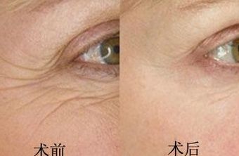 南京鳳凰島整形外科門診部的王科醫(yī)生口碑如何？聯(lián)合李敏醫(yī)生介紹及手術(shù)后的反饋，揭秘這位醫(yī)生的實(shí)力！
