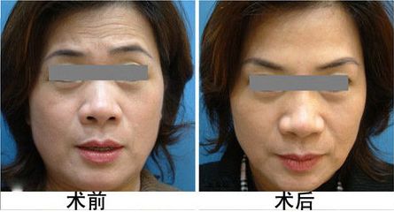 廣安阿藍(lán)醫(yī)院整形科評(píng)價(jià)，是否正規(guī)？地址詳細(xì)一覽