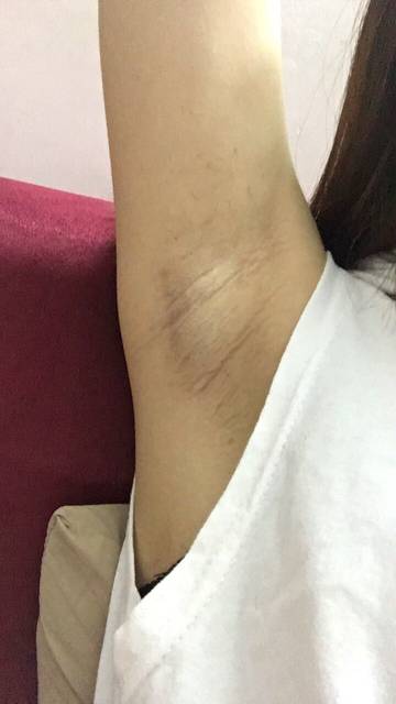 上海健橋植發(fā)技術(shù)實力如何？頭發(fā)再生效果值得期待嗎？