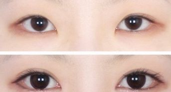 廣州韓后許滿萍醫(yī)生的專業(yè)領(lǐng)域揭秘，令人驚喜的嫩膚案例分享