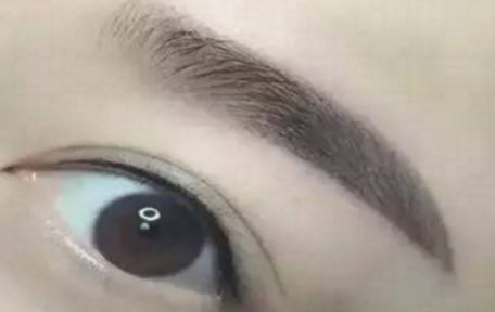 哈爾濱醫(yī)科大學(xué)二院最新整形去痦子技術(shù)揭秘，讓肌膚恢復(fù)純凈光潔