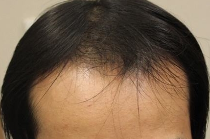 哪家醫(yī)療整形醫(yī)院是貴陽省內(nèi)口碑比較好的選擇？