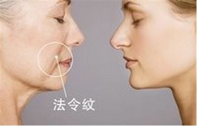 美麗改變，趙德星鼻子整形前后對(duì)比，驚艷有度！