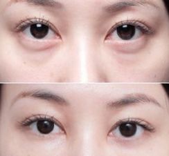 上海美萊醫(yī)院的療效一流，備受好評(píng)的醫(yī)生大揭秘！