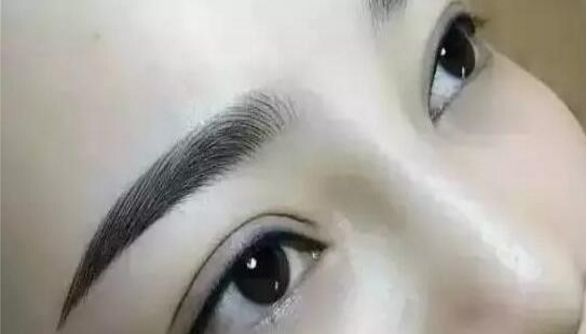重慶曹陽(yáng)的鼻子整形效果如何？醫(yī)生手藝獨(dú)步天下的真實(shí)案例分享