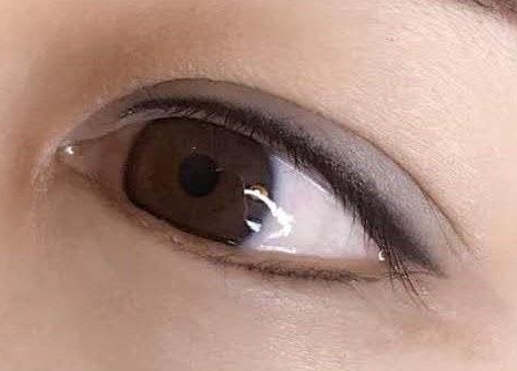 惠州有哪些鼻部整形醫(yī)院可以信賴？